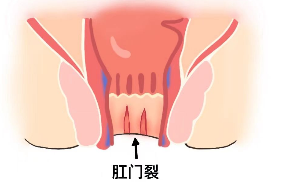 QQ图片20230112110733