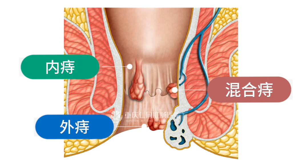 QQ图片20241112145945