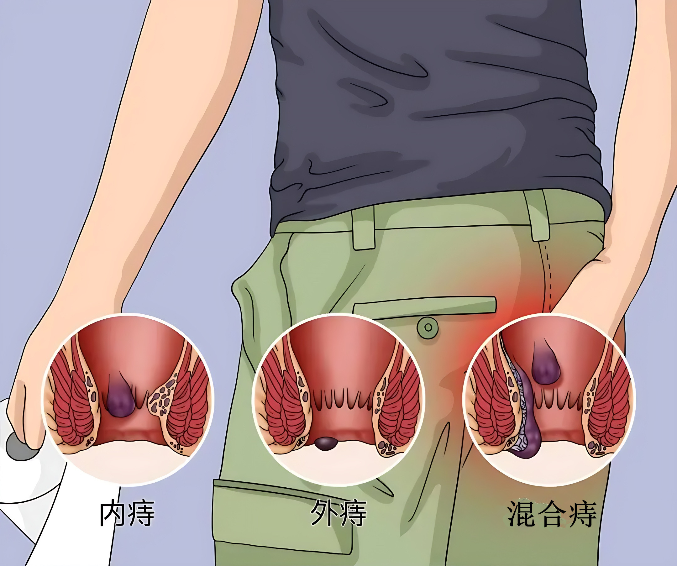aa23ae9aff464b0190df3e20f6d58d23_修复后