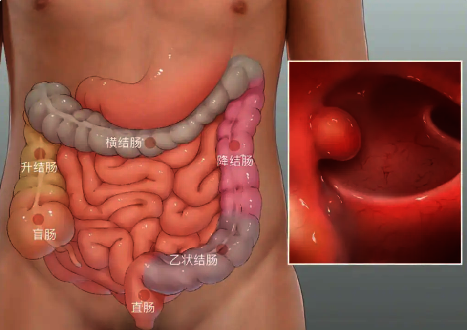 QQ图片20240508113357 QQ图片20240508113357