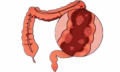 019b7140094c4946be07d20e9b0183af 019b7140094c4946be07d20e9b0183af