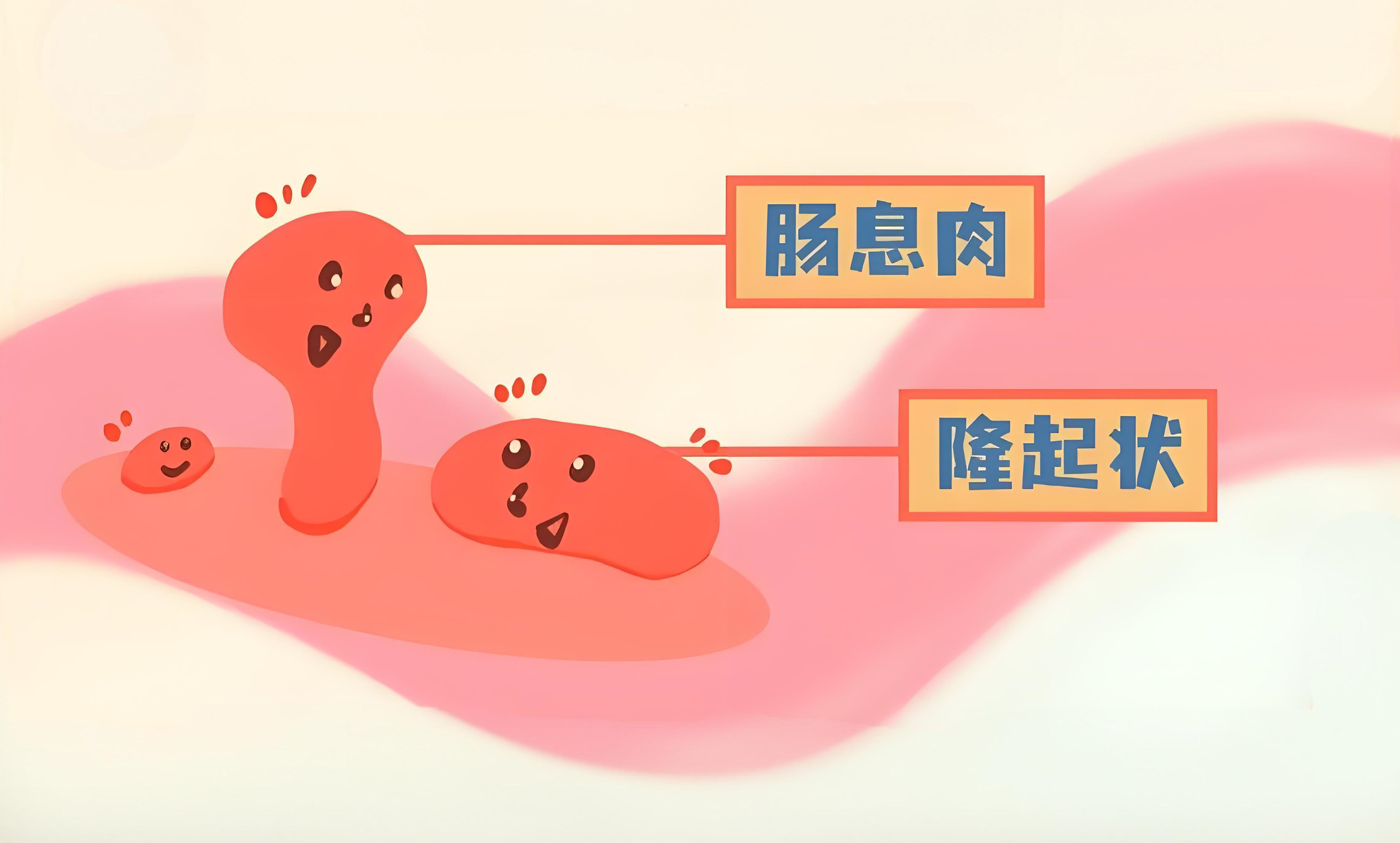 bdbef8a0-33fa-48de-aef1-7d2e0eb66aa9 bdbef8a0-33fa-48de-aef1-7d2e0eb66aa9