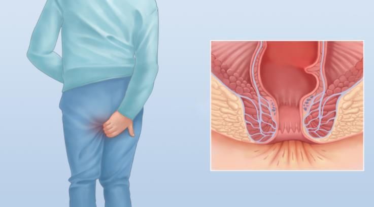 a24dc393130d82b0fcf380f31b9045746618 a24dc393130d82b0fcf380f31b9045746618