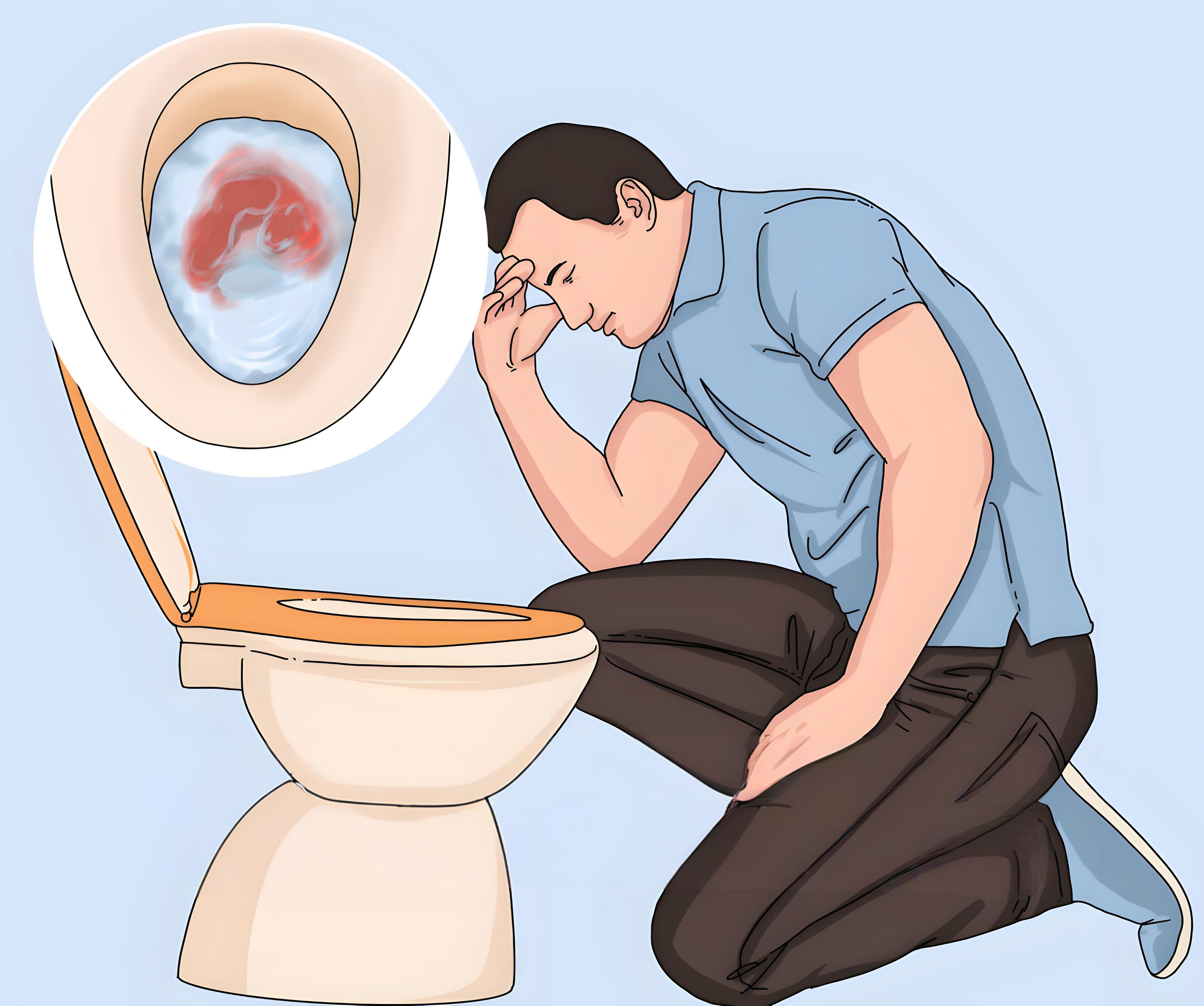 大便拉了很多鲜血的原因?