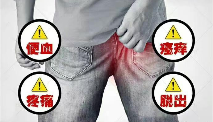 006eCmf1ly1h4c37gi48vj30j60j6dhn