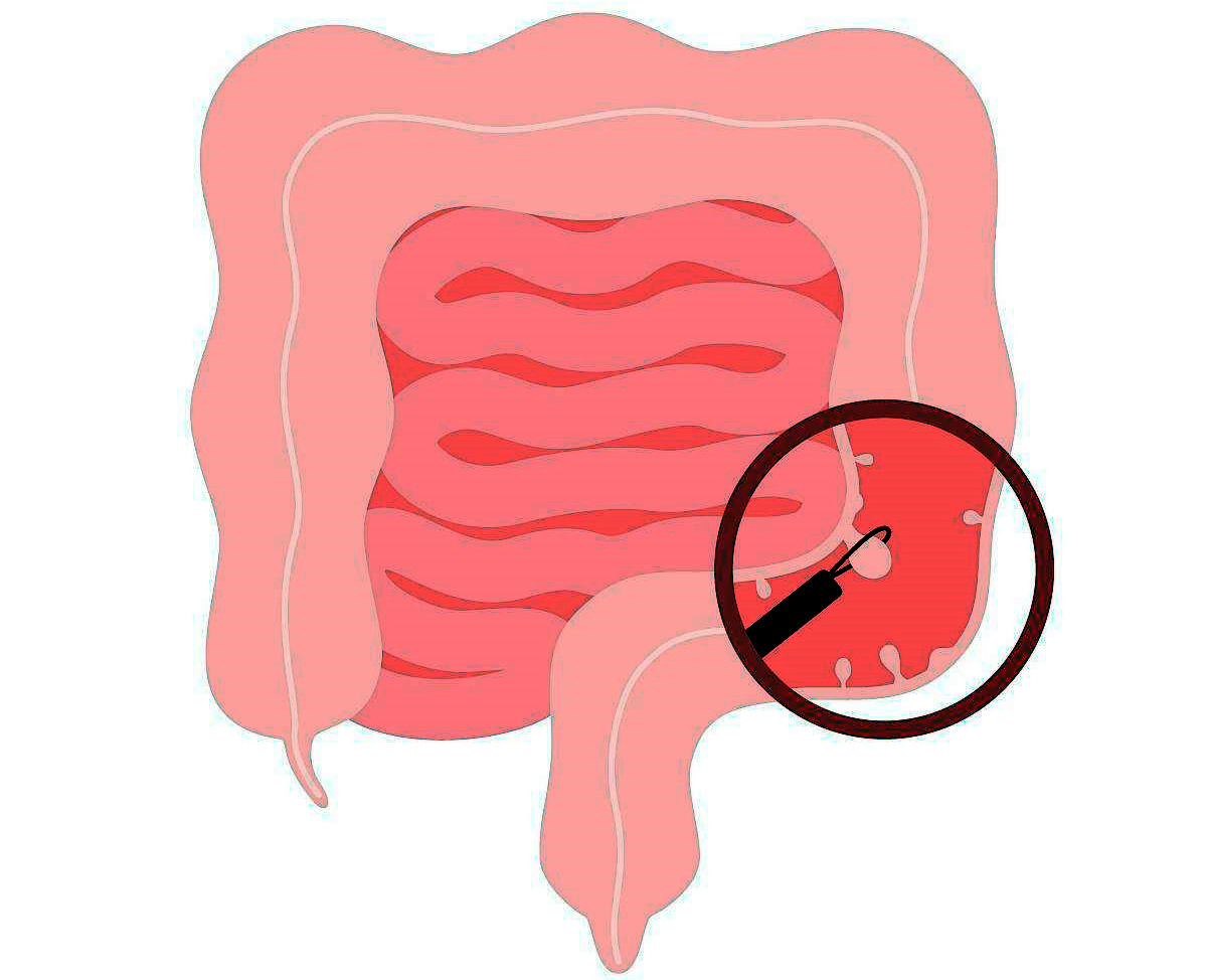 2baf54c5c6fc45bfbba95ab6b09313ac