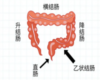 结肠炎是怎么引起的?