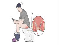 风油精治痔疮甚称一绝!