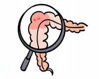 有肠息肉就要割了?