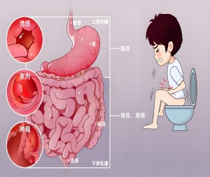 行业健康｜胃肠不适别硬扛!重庆肛肠医院周年庆推出68元胃镜早筛套餐