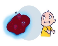 第一次便血鲜红不痛怎么回事?