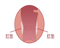 肛门有坠胀感是怎么回事