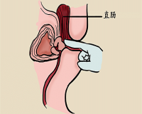 肛门指检到底有什么用?