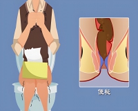 便秘有什么症状?