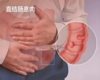 肠息肉切除就没事了吗?