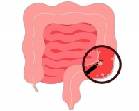 肠道里面的息肉一定要切除吗?