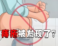 混合痔肉球脱出怎么能缩回去?