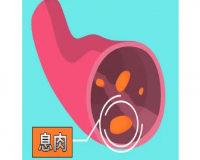 肠道息肉治疗?
