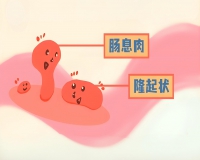 对于有肠息肉怎么办？
