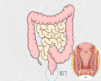 肛肠疾病不是只有痔疮吗?