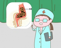 大便解不下来最快办法?