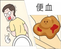便血不痛不痒是怎么回事?