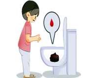 上厕所时无缘无故大便出血，这是怎么回事?