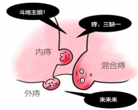 内痔出血的危险大?