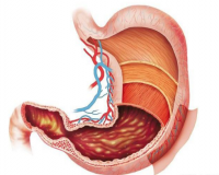 萎缩性胃炎的症状及分类