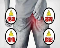 痔疮潜在危害，如何应对?