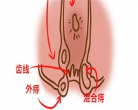 你不得不了解的痔疮危害?