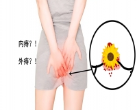 肛门部“小肉球”，这是痔疮吗?