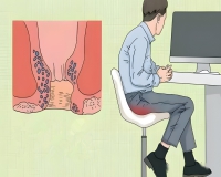 大便出血不痛的原因?