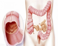 肠息肉的原因?