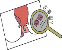 吃什么可以治痔疮?