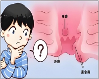 一拉屎痔疮就出血的原因?