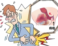 混合痔疮怎么治疗最好方法?