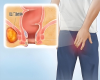 肛周脓肿术后，饮食护理?