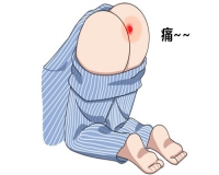 怎样判断自己有没有痔疮?