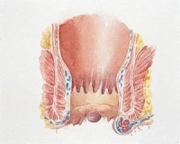人为什么会得痔疮? ​​​​