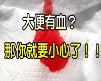 大便出血鲜红但不疼原因?