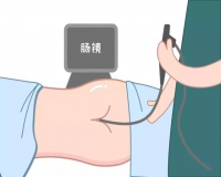 无痛肠镜过程?