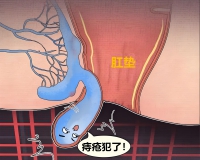 混合痔手术1999元!重庆仁同肛肠医院周年庆：含术后输液+药费，胃镜肠镜抄底价!
