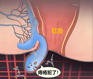 行业健康｜混合痔手术1999元!重庆仁同肛肠医院周年庆：含术后输液+药费，胃镜肠镜抄底价!