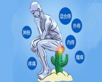 痔疮到什么程度需要手术?