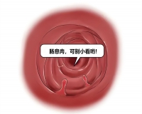 肠息肉形成的原因?