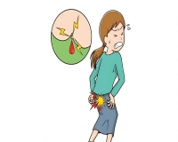 常见的痔疮出血情况?
