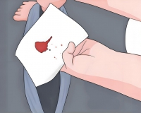 肛门稍微有点出血是怎么了?