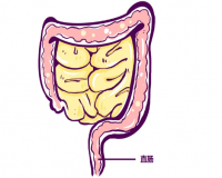 直肠炎有哪些症状表现