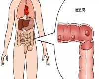 肠息肉的症状?